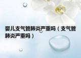 婴儿支气管肺炎严重吗（支气管肺炎严重吗）