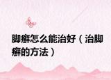 脚癣怎么能治好（治脚癣的方法）