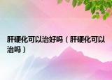 肝硬化可以治好吗（肝硬化可以治吗）