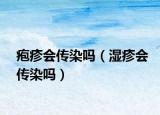 疱疹会传染吗（湿疹会传染吗）