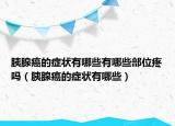 胰腺癌的症状有哪些有哪些部位疼吗（胰腺癌的症状有哪些）