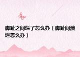 脚趾之间烂了怎么办（脚趾间溃烂怎么办）