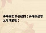 手鸡眼怎么引起的（手鸡眼是怎么形成的呢）