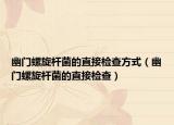 幽门螺旋杆菌的直接检查方式（幽门螺旋杆菌的直接检查）