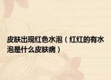 皮肤出现红色水泡（红红的有水泡是什么皮肤病）