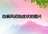 白癜风初始症状的图片