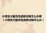 小臂及大腿急性皮肤过敏怎么办呢（小臂及大腿急性皮肤过敏怎么办）