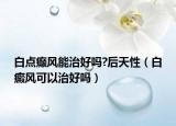 白点癫风能治好吗?后天性（白癜风可以治好吗）