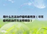 用什么方法治疗痤疮最有效（寻常痤疮的治疗方法有哪些）