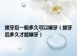 拔牙后一般多久可以镶牙（拔牙后多久才能镶牙）