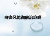 白癜风能彻底治愈吗