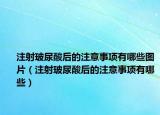 注射玻尿酸后的注意事项有哪些图片（注射玻尿酸后的注意事项有哪些）