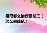 痤疮怎么治疗最彻底（怎么去痤疮）