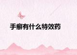 手癣有什么特效药