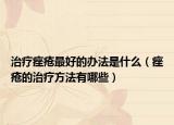 治疗痤疮最好的办法是什么（痤疮的治疗方法有哪些）