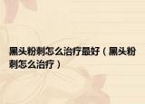 黑头粉刺怎么治疗最好（黑头粉刺怎么治疗）