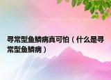 寻常型鱼鳞病真可怕（什么是寻常型鱼鳞病）