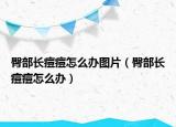 臀部长痘痘怎么办图片（臀部长痘痘怎么办）