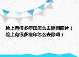 脸上有很多痘印怎么去除啊图片（脸上有很多痘印怎么去除啊）