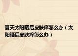 夏天太阳晒后皮肤痒怎么办（太阳晒后皮肤痒怎么办）