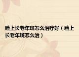脸上长老年斑怎么治疗好（脸上长老年斑怎么治）