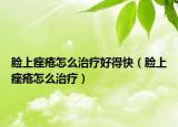 脸上痤疮怎么治疗好得快（脸上痤疮怎么治疗）
