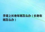 手背上长老年斑怎么办（长老年斑怎么办）