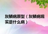 灰鳞病原型（灰鳞病现实是什么病）
