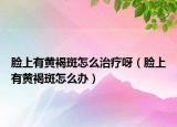 脸上有黄褐斑怎么治疗呀（脸上有黄褐斑怎么办）