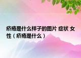 疥疮是什么样子的图片 症状 女性（疥疮是什么）