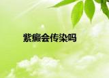 紫癜会传染吗