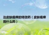 治皮肤瘙痒的特效药（皮肤瘙痒用什么药）