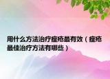 用什么方法治疗痤疮最有效（痤疮最佳治疗方法有哪些）