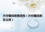 片仔癀祛斑有效吗（片仔癀祛斑怎么样）