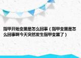 指甲开始变黑是怎么回事（指甲变黑是怎么回事啊今天突然发生指甲变黑了）
