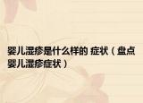 婴儿湿疹是什么样的 症状（盘点婴儿湿疹症状）