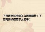 下巴两侧长痘痘怎么回事图片（下巴两侧长痘痘怎么回事）