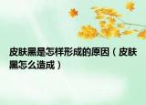 皮肤黑是怎样形成的原因（皮肤黑怎么造成）