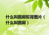 什么叫圆肩驼背图片（什么叫圆肩）