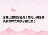 牙龈出血如何消炎（如何认识牙龈炎和怎样去维护牙龈出血）
