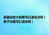 鼻翼比较大的痣可以激光点吗（鼻子长痣可以激光吗）