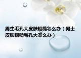 男生毛孔大皮肤粗糙怎么办（男士皮肤粗糙毛孔大怎么办）