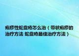 疱疹性蛇盘疮怎么治（带状疱疹的治疗方法 蛇盘疮最佳治疗方法）
