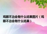 鸡眼不治会有什么结果图片（鸡眼不治会有什么结果）