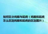 如何区分鸡眼与跖疣（鸡眼和跖疣怎么区别鸡眼和跖疣的区别图片）