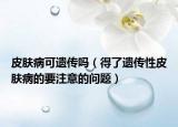 皮肤病可遗传吗（得了遗传性皮肤病的要注意的问题）