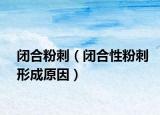 闭合粉刺（闭合性粉刺形成原因）
