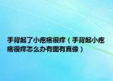 手背起了小疙瘩很痒（手背起小疙瘩很痒怎么办有图有真像）