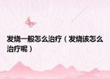 发烧一般怎么治疗（发烧该怎么治疗呢）