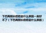 下巴两侧长痘痘是什么原因一直好不了（下巴两侧长痘痘是什么原因）